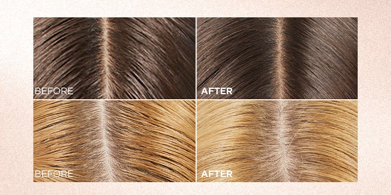 In Article How To Reduce Oily Hair EverPure Hyaluron Range